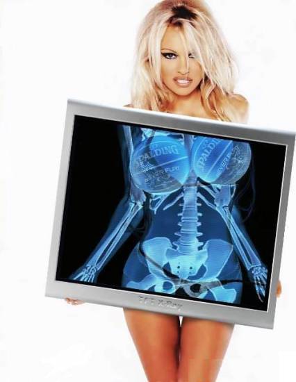 Blonde Funny Pictures Pamal's X-Ray