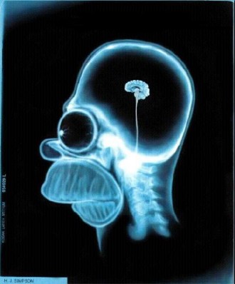 Facebook Funny Pictures Homer had a CAT scan